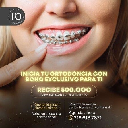 Bonus of 500,000 for your Orthodontic Treatment