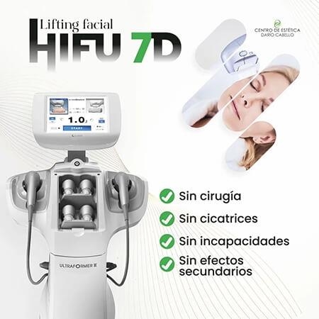 Lifting facial Hifu 7D