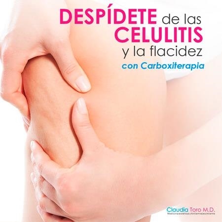 Cellulite treatment