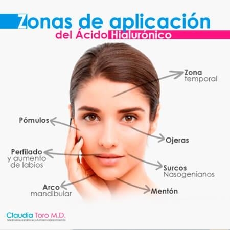 Hyaluronic acid application areas