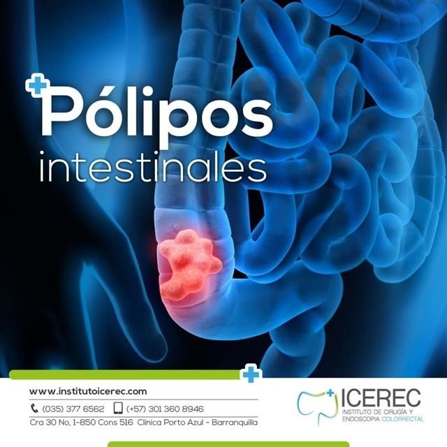 Pólipos intestinales 