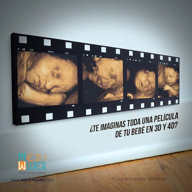 
3D and 4D ultrasounds