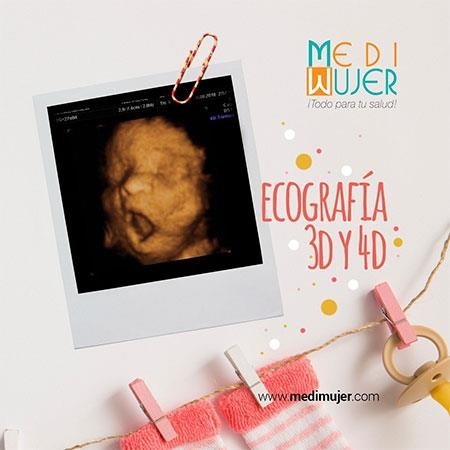  3D and 4D ultrasound