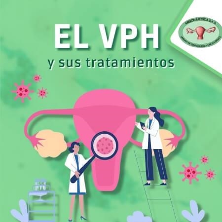 Tratamientos para VPH