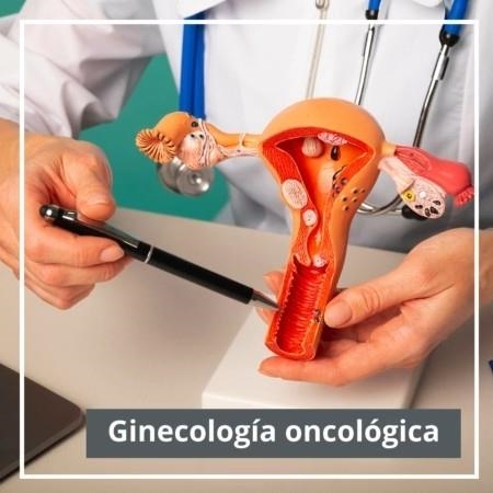 Consulta ginecología oncológica