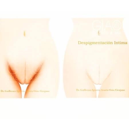 Genital depigmentation