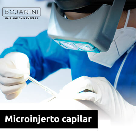 Microinjerto capilar