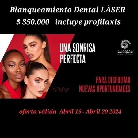 Blanqueamiento Dental Láser por $350.000