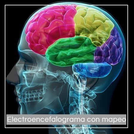 Electroencephalogram with mapping