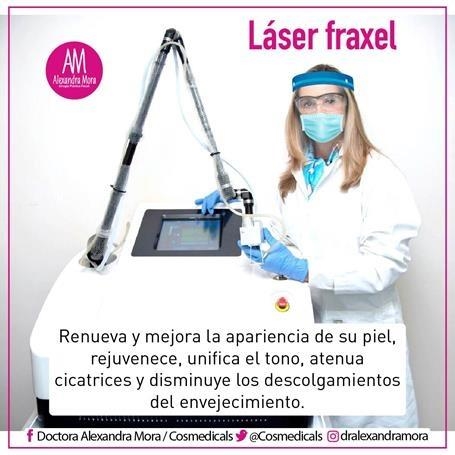 Fraxel laser