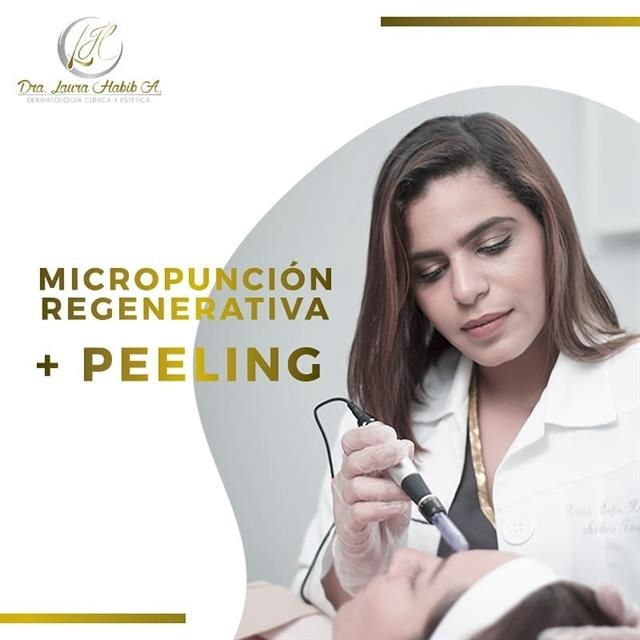 Micropunción regenerativa + Peeling