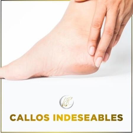 Callos indeseables 