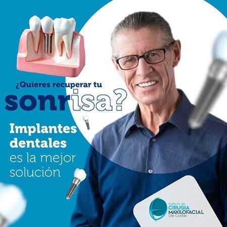  Implantes dentales