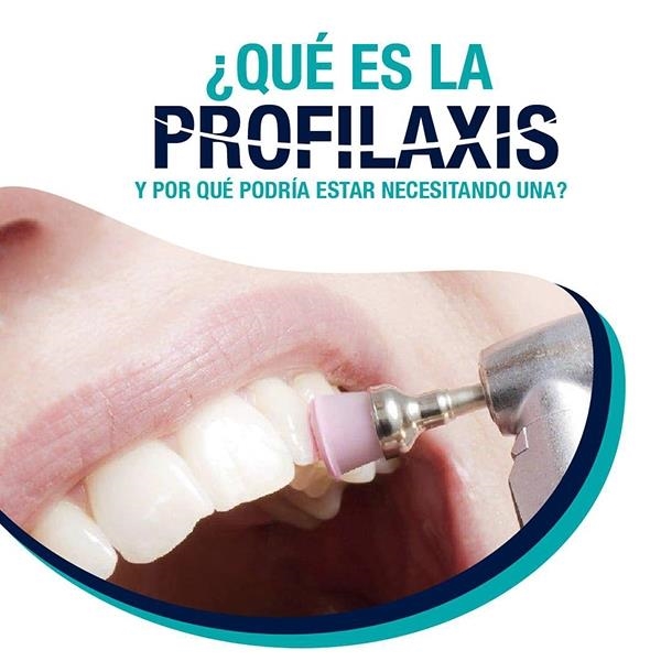 Profilaxis dental