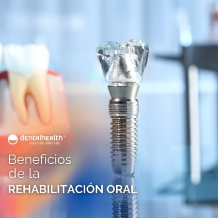 Rehabilitación oral