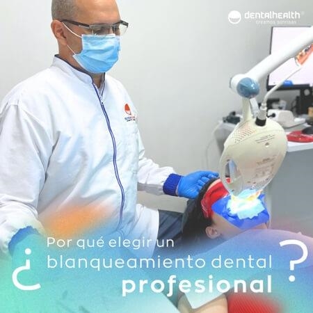 Blanqueamiento dental profesional 