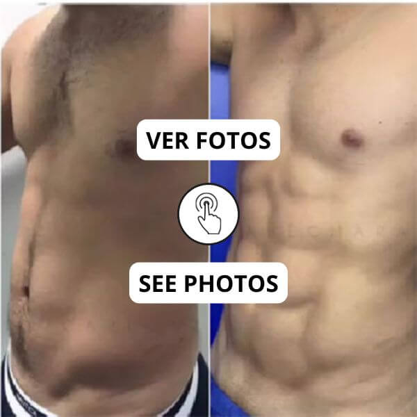 Men Abdominal Etching