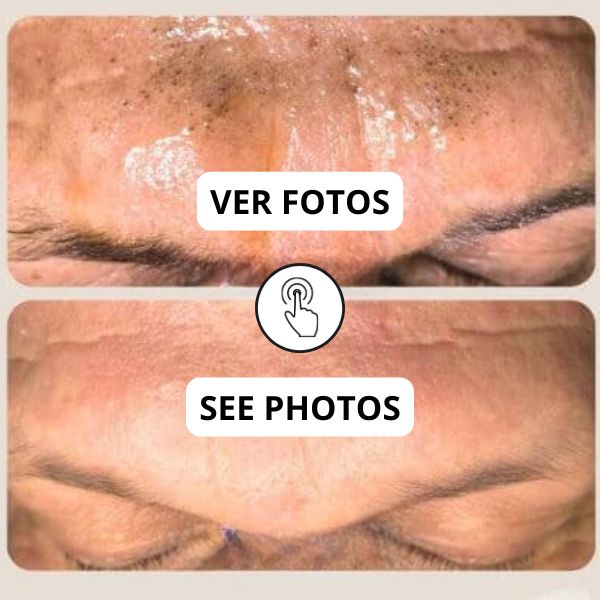 Higiene facial