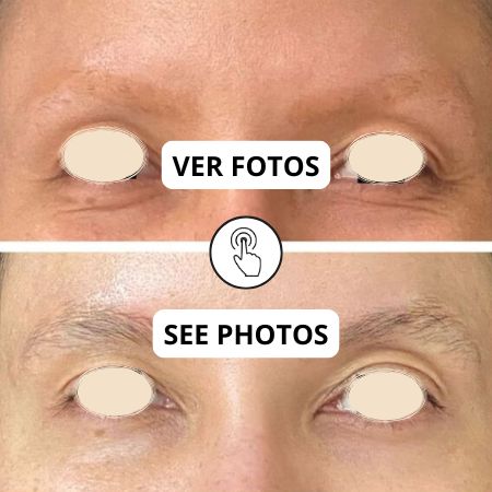 Crecimiento de cejas