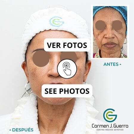 Hilos tensores