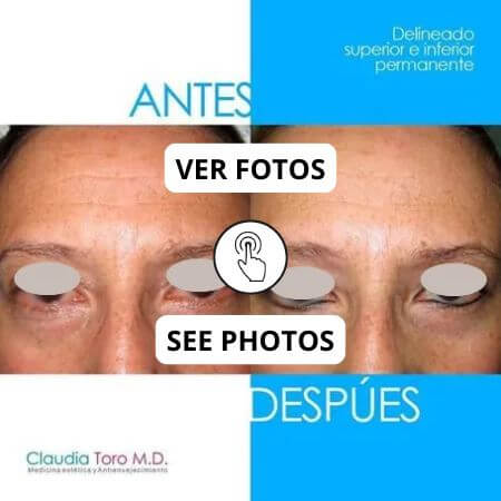 Microblading