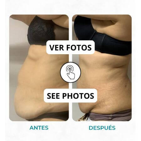 Tratamiento para reducir medidas