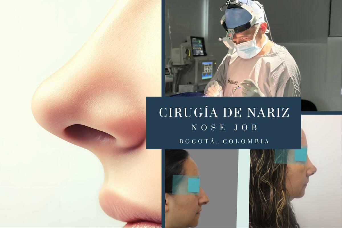 Modern Rhinoplasty in Bogotá: Piezoelectric and Surgical Motor Technology for Natural Results