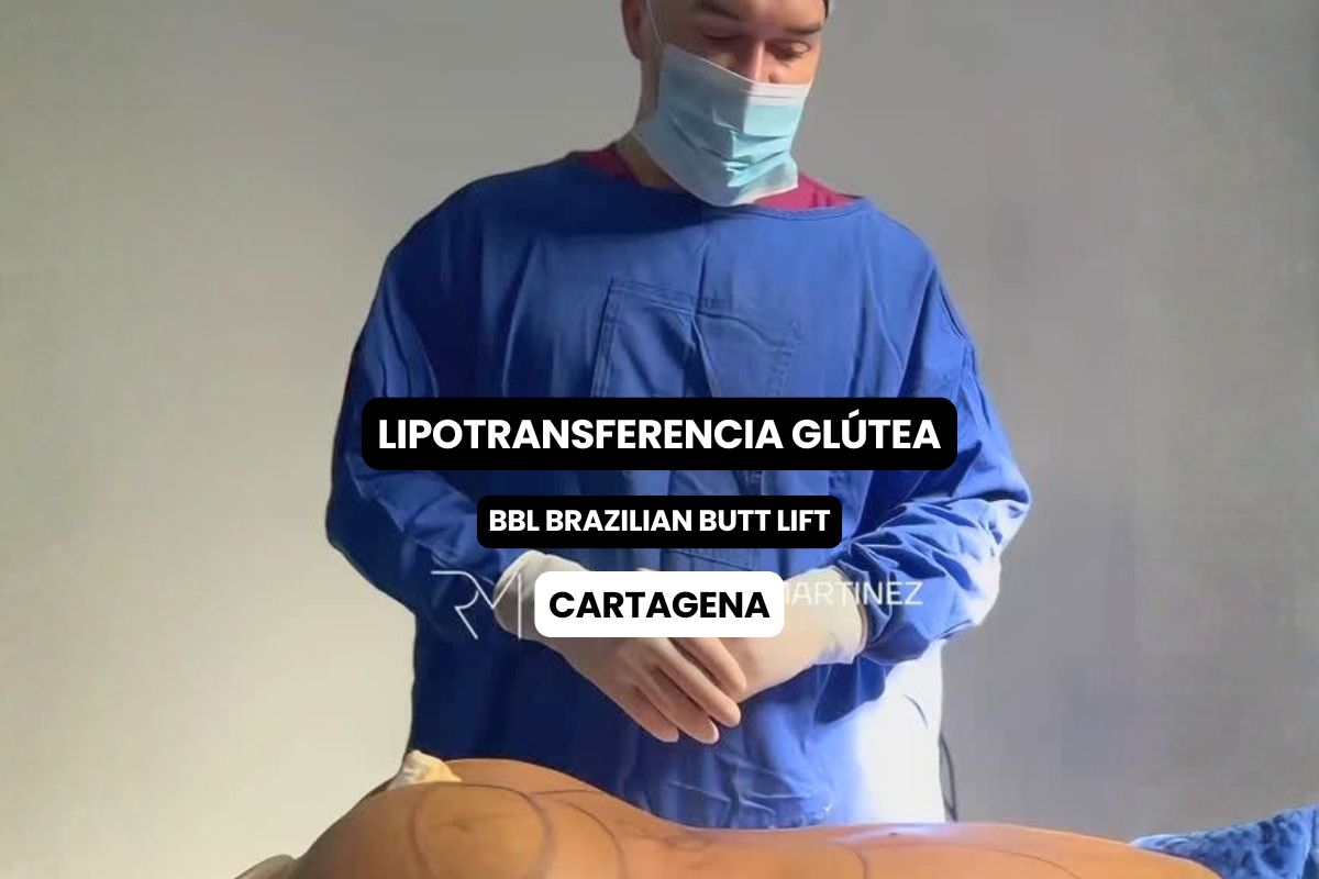 Lipotransferencia Glútea en Cartagena: Moldea tu Figura y Aumenta tus Glúteos con tu Propia Grasa