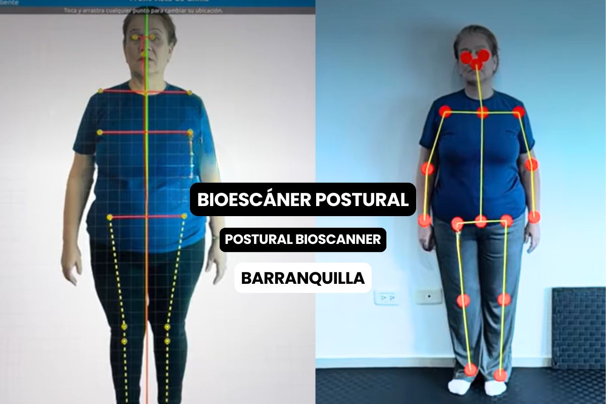 BioEscáner Postural en Barranquilla: Encuentre la Verdadera Causa de su Dolor