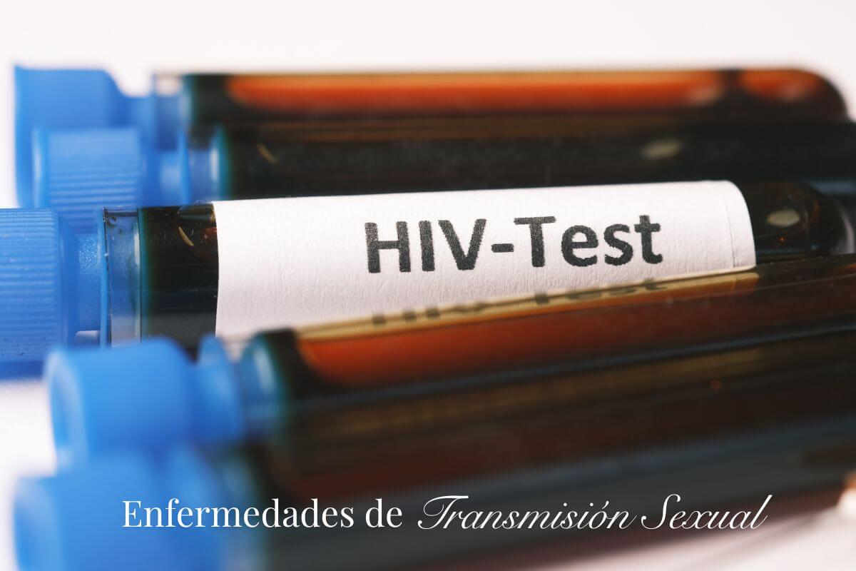 Bernardo Huyke Especialista en Enfermedades de Transmisión Sexual #3