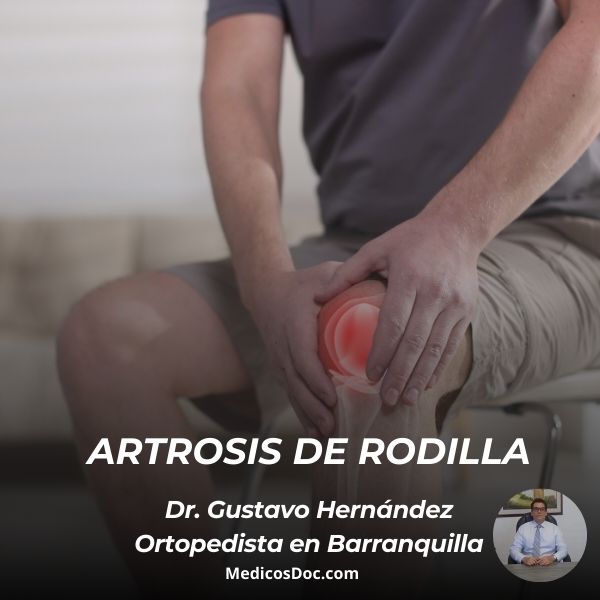 Artrosis de rodilla
