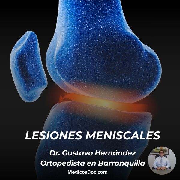 Lesiones en meniscos