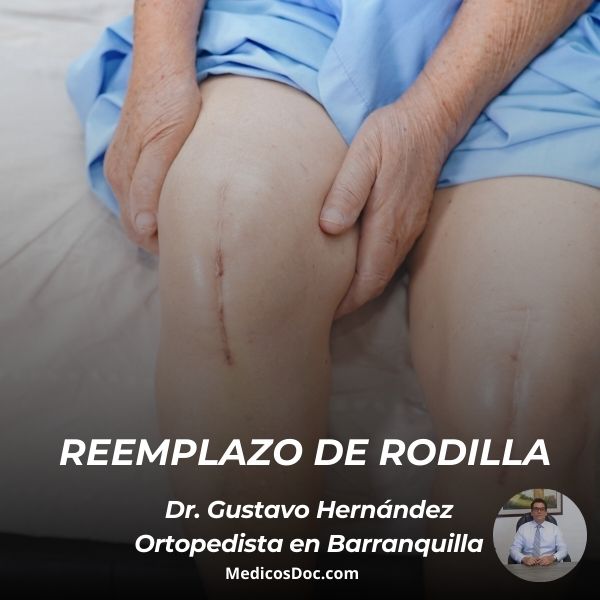 Reemplazo de rodilla 