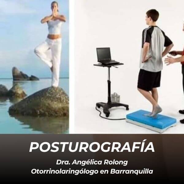 Posturografía