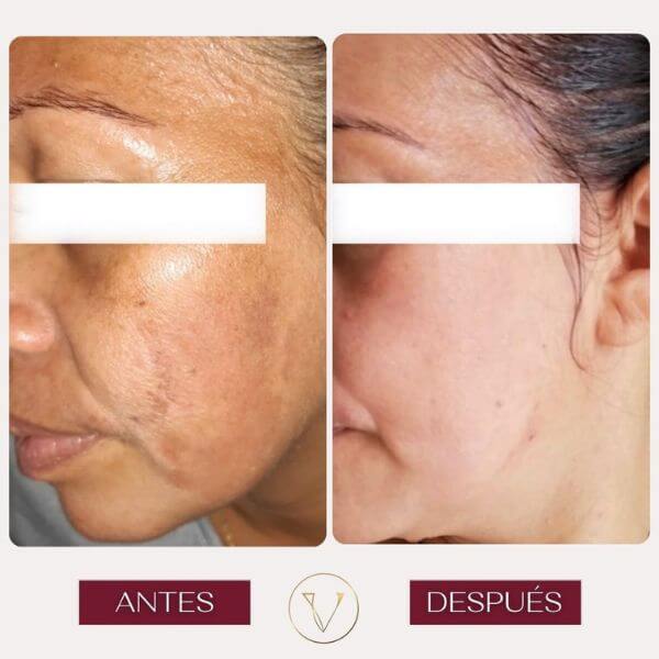 Dark spots