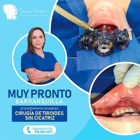 Cirugía de tiroides sin cicatriz