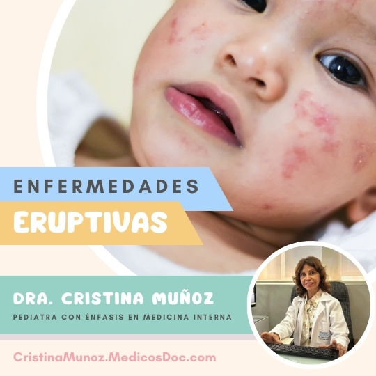 Enfermedades eruptivas