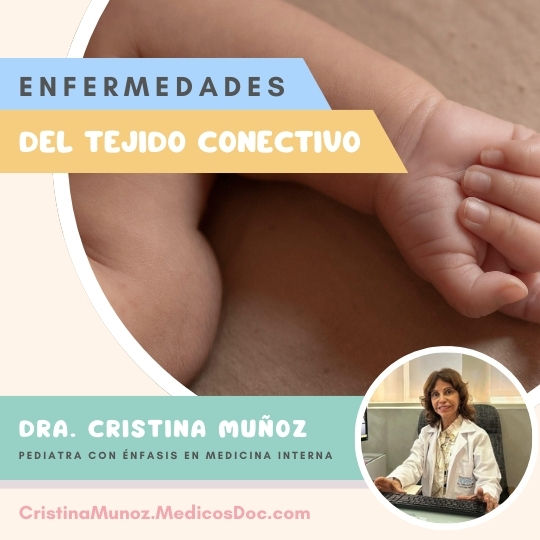 Enfermedades del tejido conectivo