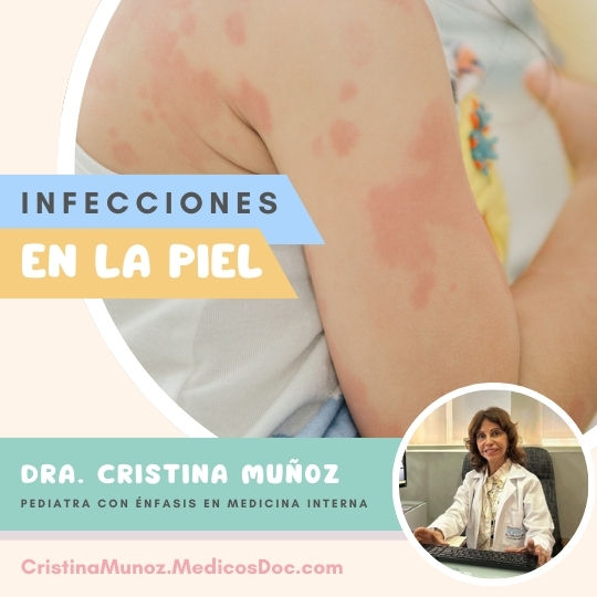Skin infections in children