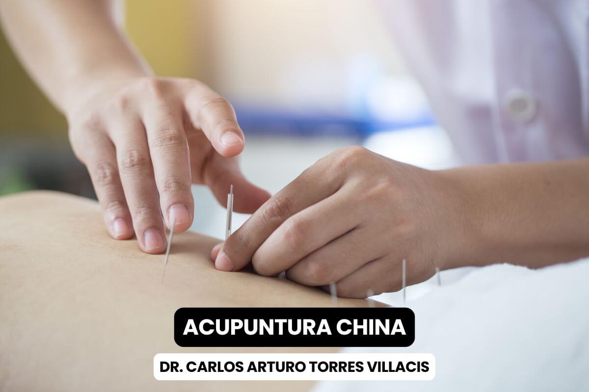 Acupuntura China: Beneficios, Usos, Riesgos y Respuestas del Dr. Carlos A. Torres