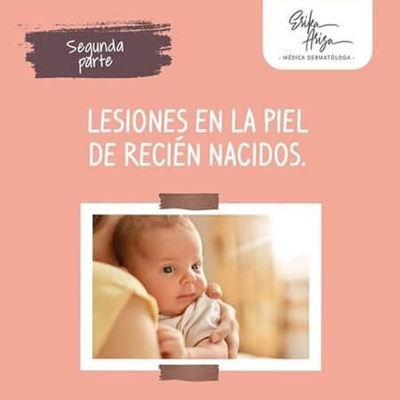 Newborn skin lesions