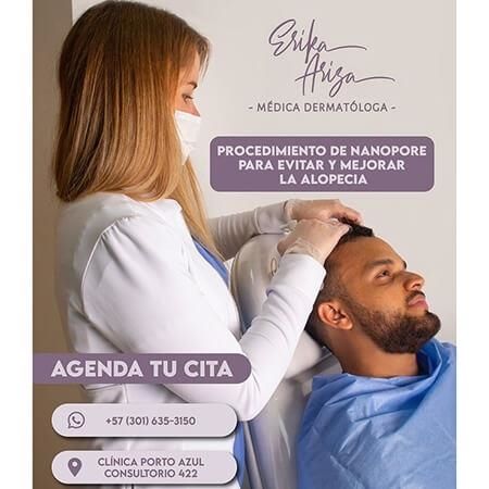 Tratamiento para alopecia 