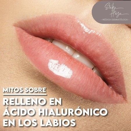 Rellenos de labios