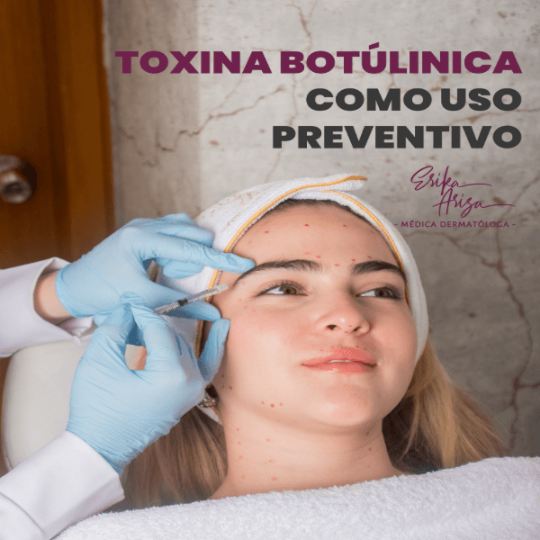 Toxina botulínica preventiva