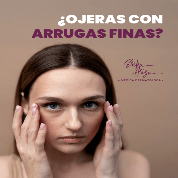 Tratamiento de ojeras