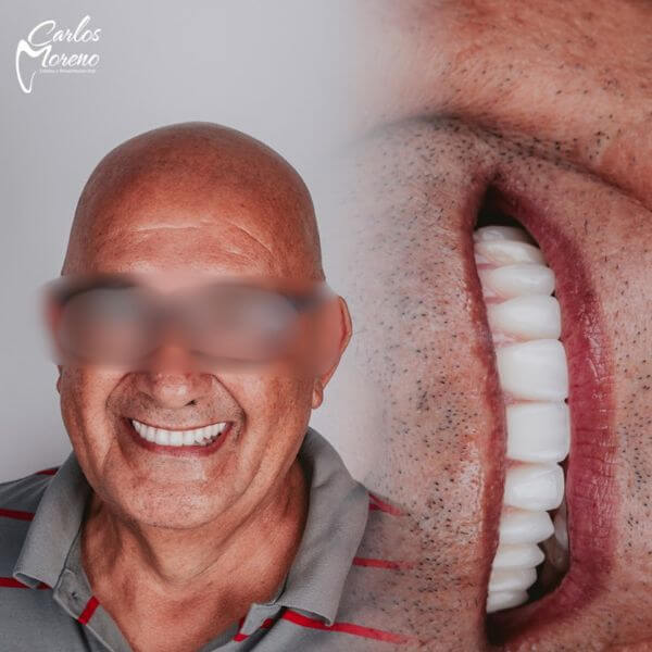 Dentures