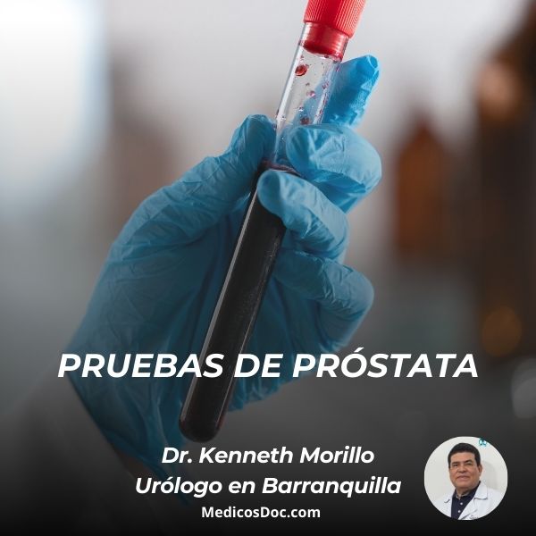 Pruebas de la próstata