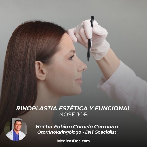 Rinoplastia estética y funcional