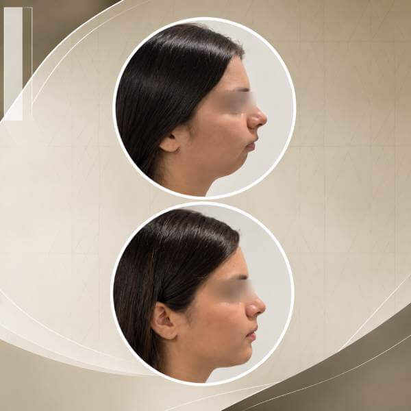 Oral and Maxillofacial Surgery