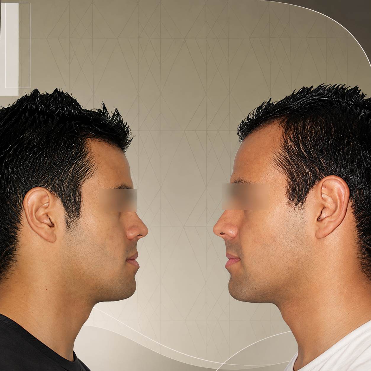 Oral and Maxillofacial Surgery